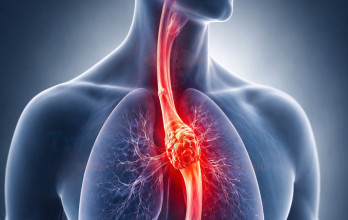 Blog Thumbnail Image